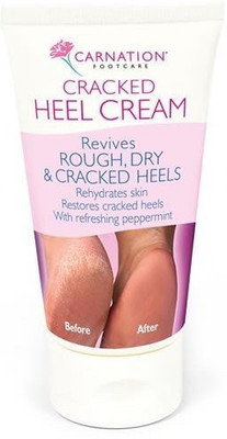 

Carnation Cracked Heel Cream(104.1 ml)