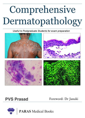 Comprehensive Dermatopathology, useful to postgraduate students for examination preparation(English, Paperback, PVS Prasad)