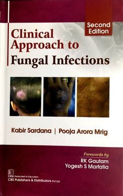 Clinical Approach to Fungal Infections(English, Paperback, Sardana Kabir)