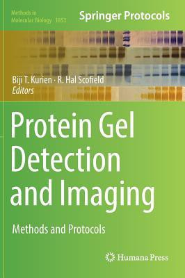 Protein Gel Detection and Imaging(English, Hardcover, unknown)