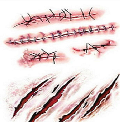 

Generic Blood Injury Sticker(wound queen)
