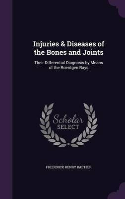 Injuries & Diseases of the Bones and Joints(English, Hardcover, Baetjer Frederick Henry)