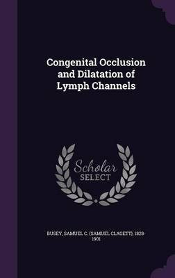 Congenital Occlusion and Dilatation of Lymph Channels(English, Hardcover, Busey Samuel C 1828-1901)