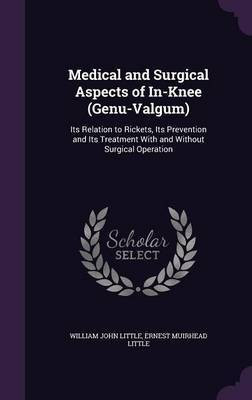 Medical and Surgical Aspects of In-Knee (Genu-Valgum)(English, Hardcover, Little William John)