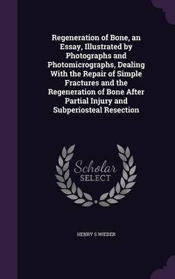 Regeneration of Bone, an Essay, Illustrated by Photographs and Photomicrographs, Dealing With the Repair of Simple Fractures and the Regeneration of Bone After Partial Injury and Subperiosteal Resection(English, Hardcover, Wieder Henry S)