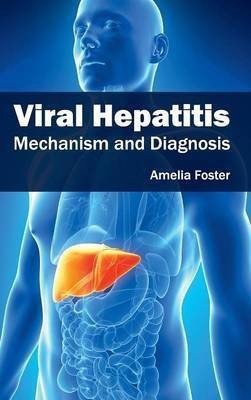 Viral Hepatitis: Mechanism and Diagnosis(English, Hardcover, unknown)