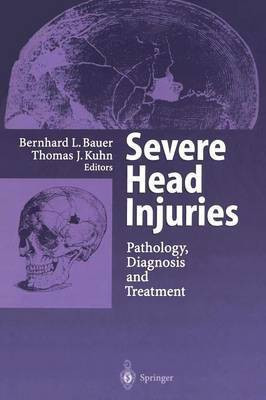 Severe Head Injuries(English, Paperback, unknown)