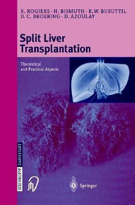 Split liver transplantation(English, Paperback, unknown)