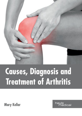 Causes, Diagnosis and Treatment of Arthritis(English, Hardcover, unknown)