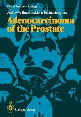 Adenocarcinoma of the Prostate(English, Paperback, unknown)
