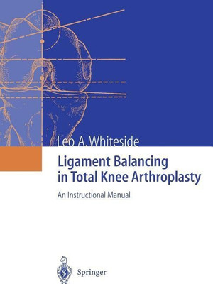 Ligament Balancing in Total Knee Arthroplasty(English, Paperback, Whiteside Leo A.)