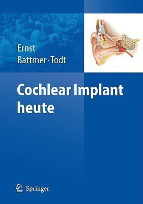 Cochlear Implant Heute(German, Paperback, unknown)