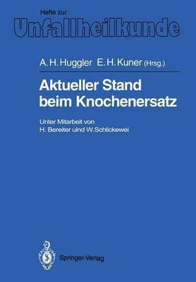 Aktueller Stand beim Knochenersatz(German, Paperback, unknown)