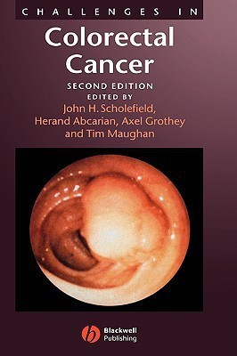 Challenges in Colorectal Cancer(English, Hardcover, unknown)
