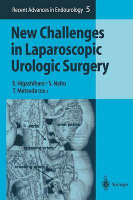 New Challenges in Laparoscopic Urologic Surgery(English, Paperback, unknown)