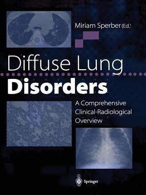 Diffuse Lung Disorders(English, Paperback, unknown)