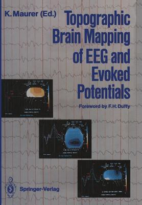Topographic Brain Mapping of EEG and Evoked Potentials(English, Paperback, unknown)
