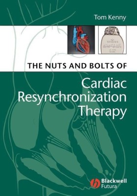 The Nuts and Bolts of Cardiac Resynchronization Therapy(English, Paperback, Kenny Tom)