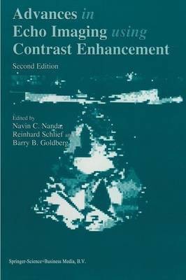 Advances in Echo Imaging Using Contrast Enhancement(English, Paperback, unknown)