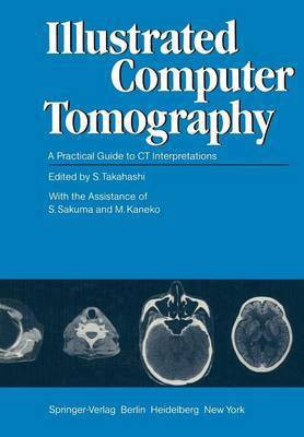Illustrated Computer Tomography(English, Paperback, unknown)