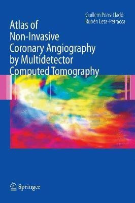 Atlas of Non-Invasive Coronary Angiography by Multidetector Computed Tomography(English, Hardcover, unknown)