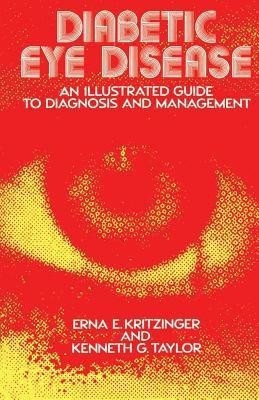 Diabetic Eye Disease(English, Paperback, Kritzinger E.E.)