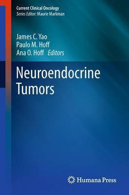 Neuroendocrine Tumors(English, Paperback, unknown)