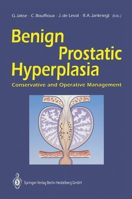 Benign Prostatic Hyperplasia(English, Paperback, unknown)