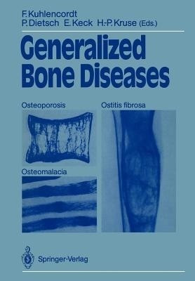 Generalized Bone Diseases(English, Paperback, unknown)