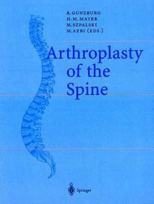 Arthroplasty of the Spine(English, Paperback, unknown)
