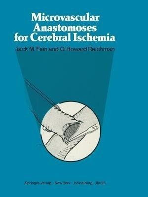 Microvascular Anastomoses for Cerebral Ischemia(English, Paperback, unknown)