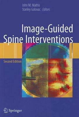 Image-Guided Spine Interventions(English, Paperback, unknown)