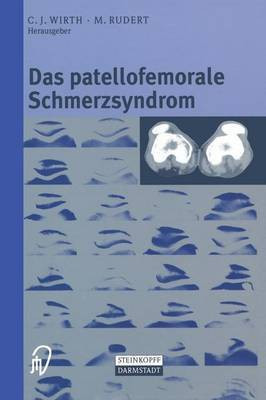 Das patellofemorale Schmerzsyndrom(German, Paperback, unknown)