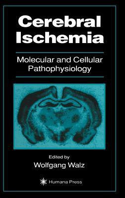 Cerebral Ischemia(English, Hardcover, unknown)