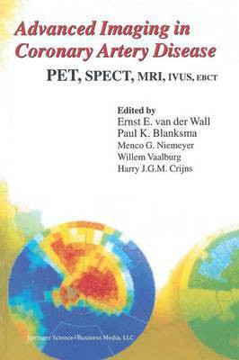 Advanced Imaging in Coronary Artery Disease(English, Paperback, unknown)