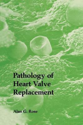 Pathology of Heart Valve Replacement(English, Paperback, Rose A.G.)