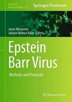 Epstein Barr Virus(English, Hardcover, unknown)