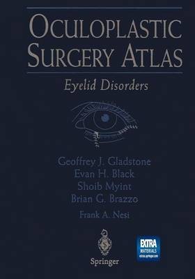 Oculoplastic Surgery Atlas(English, Paperback, unknown)