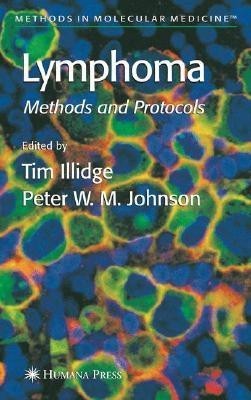 Lymphoma(English, Hardcover, unknown)