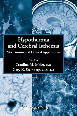 Hypothermia and Cerebral Ischemia(English, Hardcover, unknown)