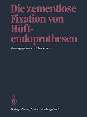 Die zementlose Fixation von Hueftendoprothesen(German, Paperback, unknown)