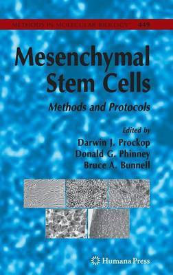 Mesenchymal Stem Cells  - Methods and Protocols(English, Hardcover, unknown)