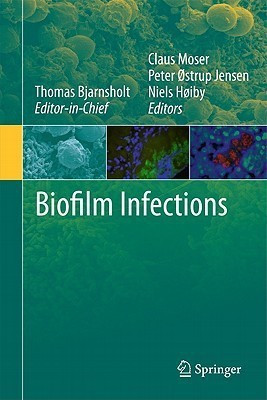 Biofilm Infections(English, Hardcover, unknown)