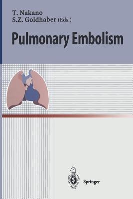 Pulmonary Embolism(English, Paperback, unknown)