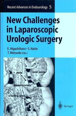 New Challenges in Laparoscopic Urologic Surgery(English, Hardcover, unknown)