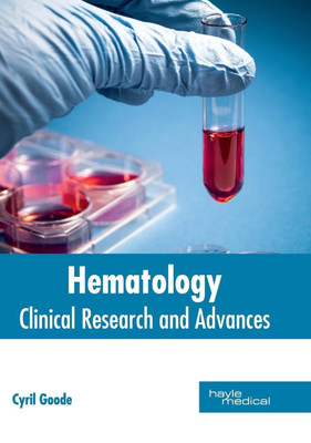 Hematology: Clinical Research and Advances(English, Hardcover, unknown)