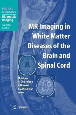 MR Imaging in White Matter Diseases of the Brain and Spinal Cord(English, Hardcover, unknown)