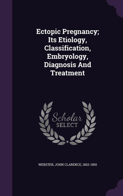 Ectopic Pregnancy; Its Etiology, Classification, Embryology, Diagnosis And Treatment(English, Hardcover, unknown)