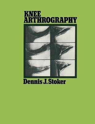 Knee Arthrography(English, Paperback, Stoker Dennis J.)