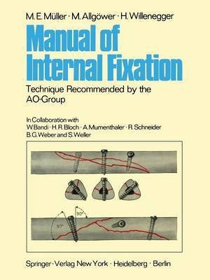 Manual of Internal Fixation(English, Paperback, Muller M. E.)